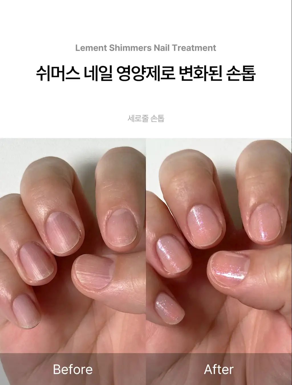 [NEW 케어2종] 르멘트 반짝임 다즐링 네일 하드너 & 쉬머스 네일 영양제 상세페이지 29